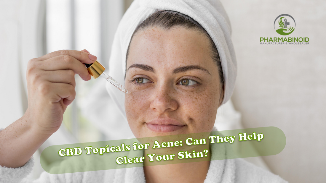 CBD Topicals for Acne: Can They Help Clear Your Skin?